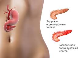 потивопоказания к узи поджелудочной железы