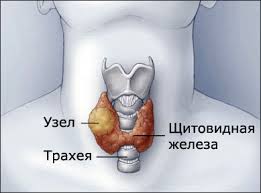 узи щитовидной железы на дому